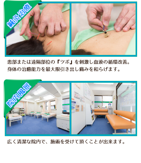鍼灸治療…患部または遠隔部位の『ツボ』を刺激し血液の循環改善。身体の治癒能力を最大限引き出し痛みを和らげます。院内風景…広く清潔な院内で、施術を受けて頂くことが出来ます